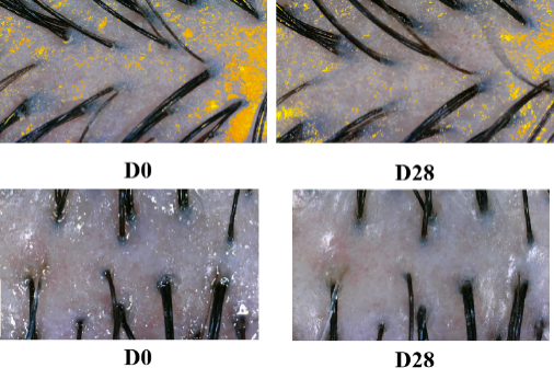 頭皮,健康,頭皮脫屑,頭皮皮脂