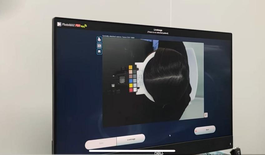 Scalp,health,Cosmetc,Efficacy,Evaluation